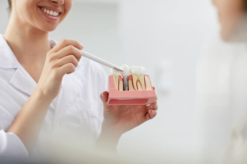 Dental Crowns: The Key to Fixing Damaged Teeth and Boosting Confidence