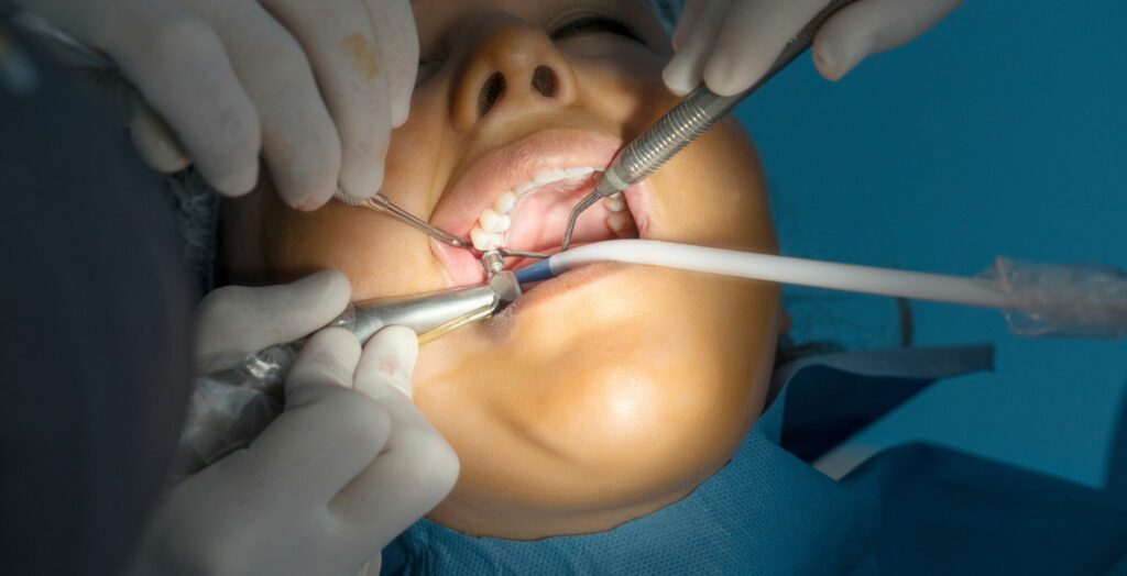 Dental implant surgery, Tooth implant procedure, Dental implant placement, Oral surgery for implants, Steps of implant surgery, Dental implant recovery, Implant surgery process, Bone integration with implant
