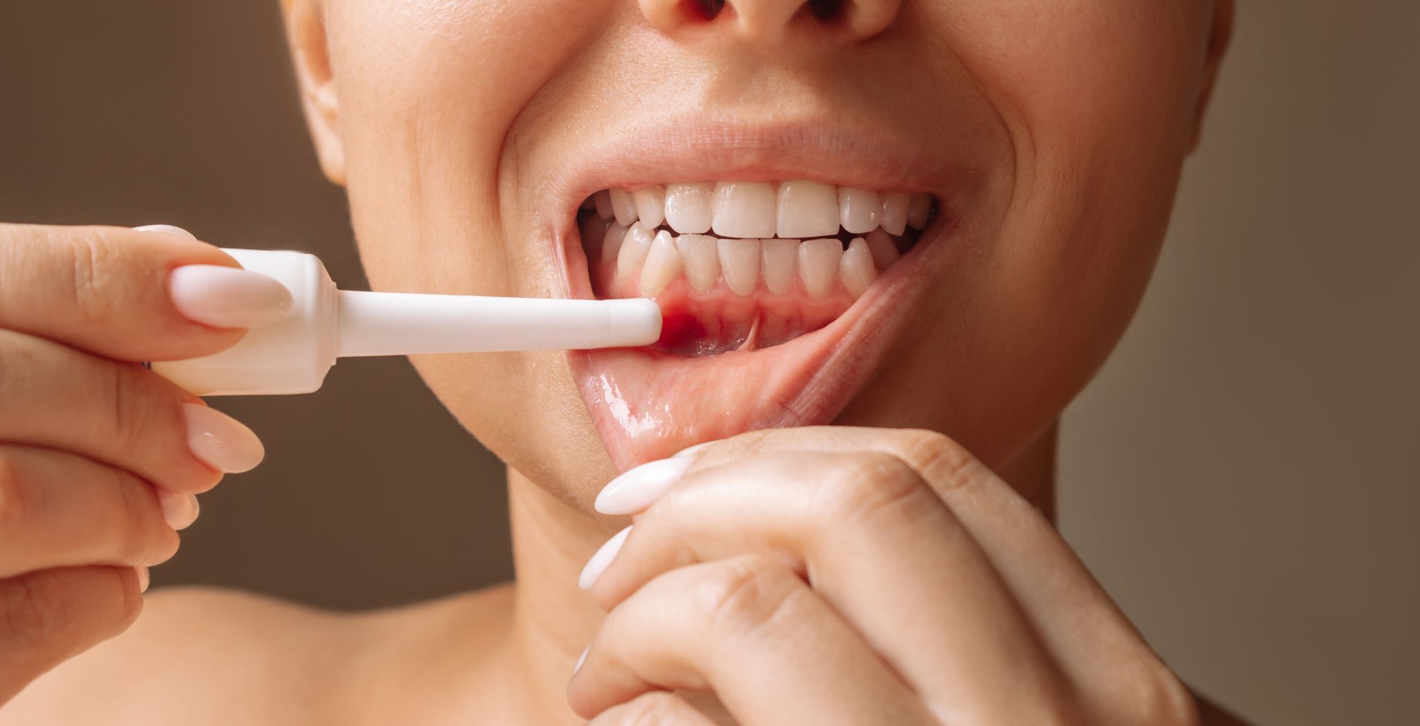 Gum recession treatment cost, I healed my receding gums, Gum recession treatment Australia, Gum recession treatment Sydney, Receding gums pain treatment, Gum recession cause, Bruxism gum recession treatment, Is gum recession normal, Gum recession treatment